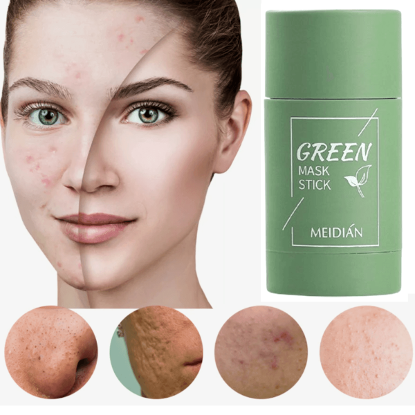 Mask green™ - Máscara removedoras de cravos Online Hot Sale